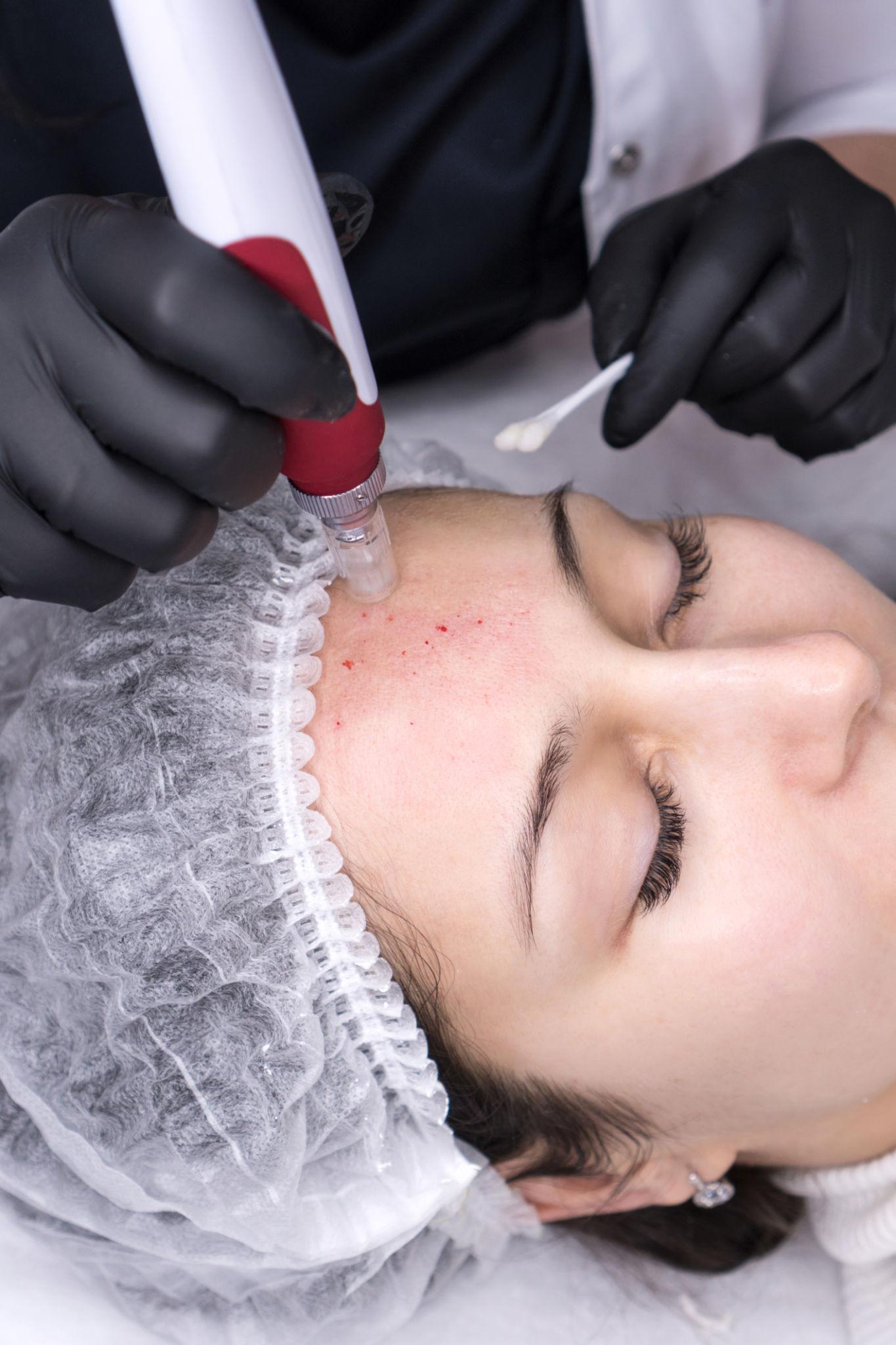 Skin Excellence : maîtrisez l’esthétique cutanée moderne
