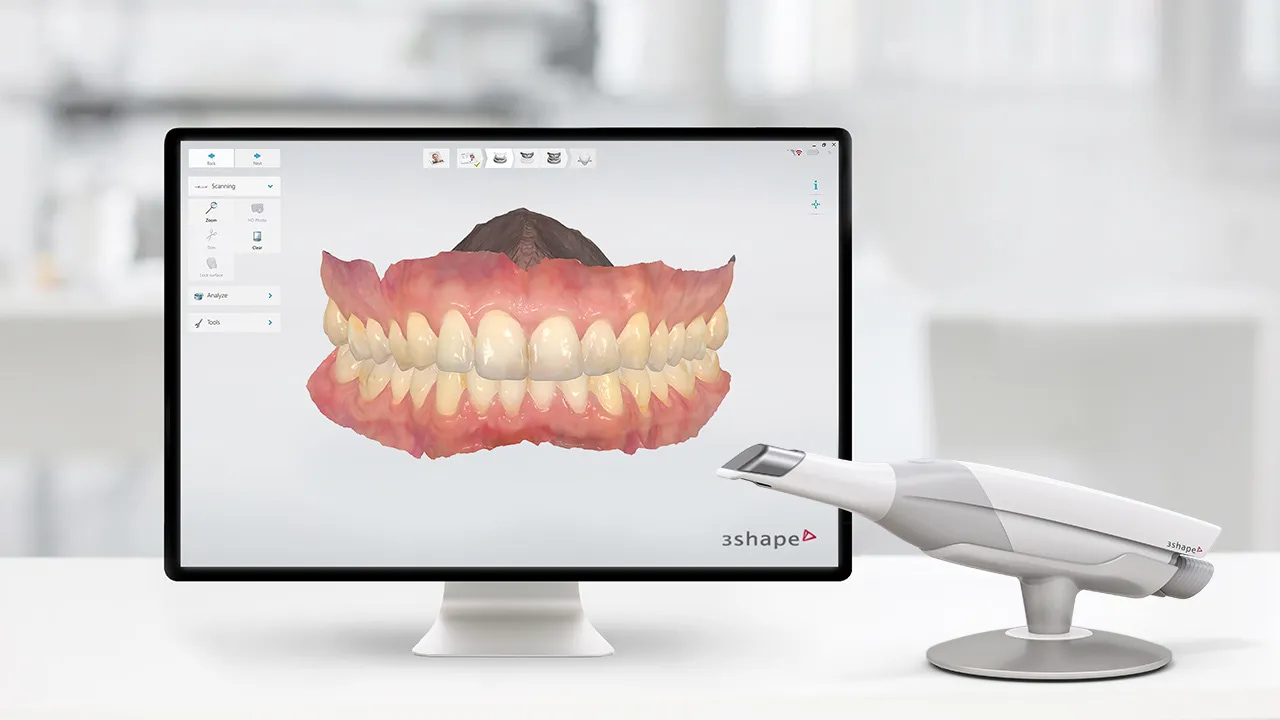 Digital Smile & Implant Workflow — photo 1