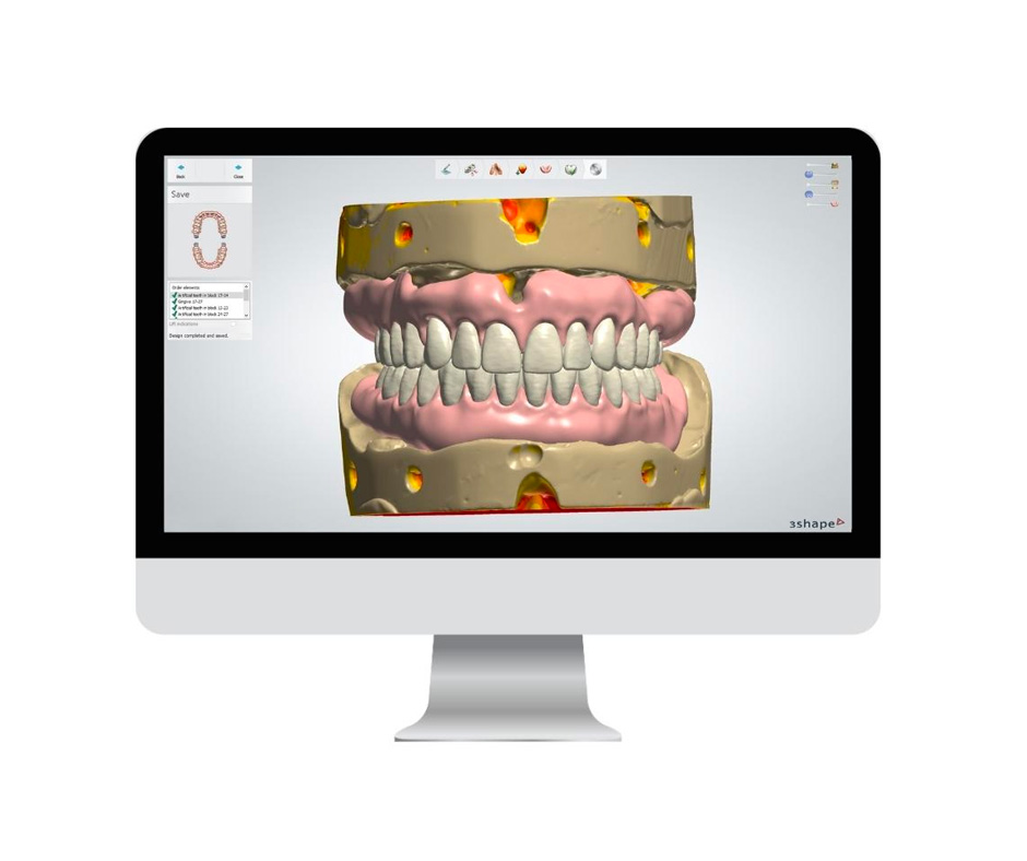 Digital Smile & Implant Workflow — photo 2