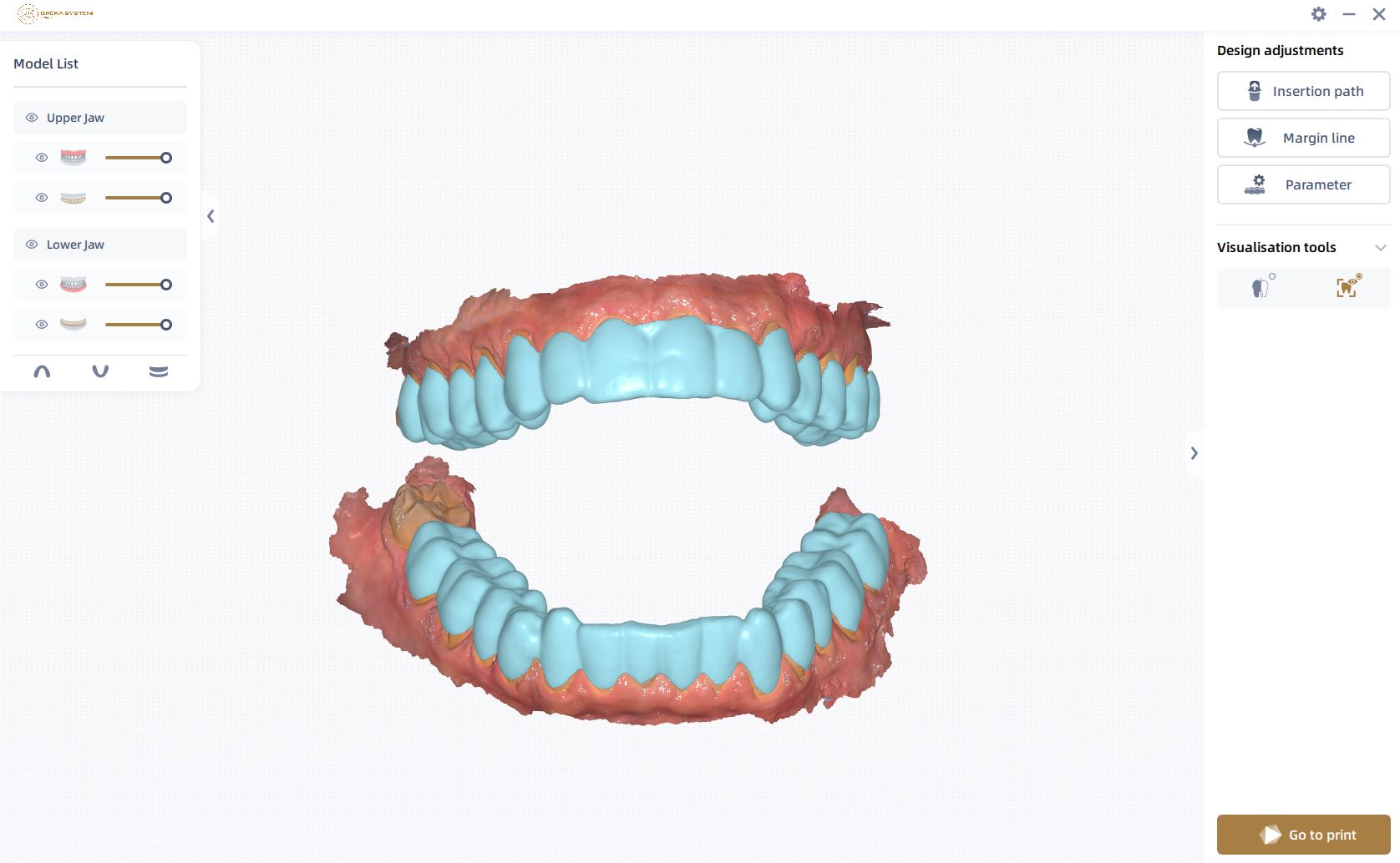 Digital Smile & Implant Workflow — photo 3