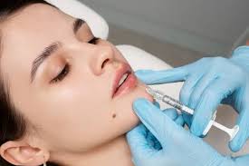Intégration de la dentisterie esthétique et cosmétique du visage: Botox et produits de comblement dermique (THEORIE + WORKSHOP) + LASER DENTAIRE