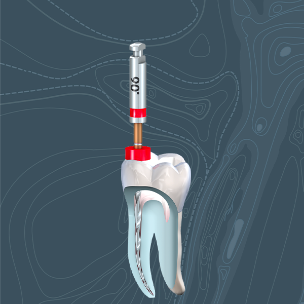Les Fondamentaux de l’Endodontie Clinique : Accès, Mise en Forme et Obturation  (Théorie et pratique)